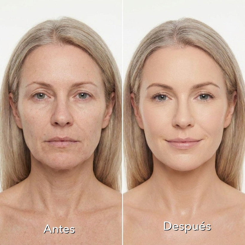Antes y después con Lambrie